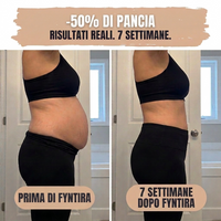 Slip Modellante Post-Parto — Compressione 360°
